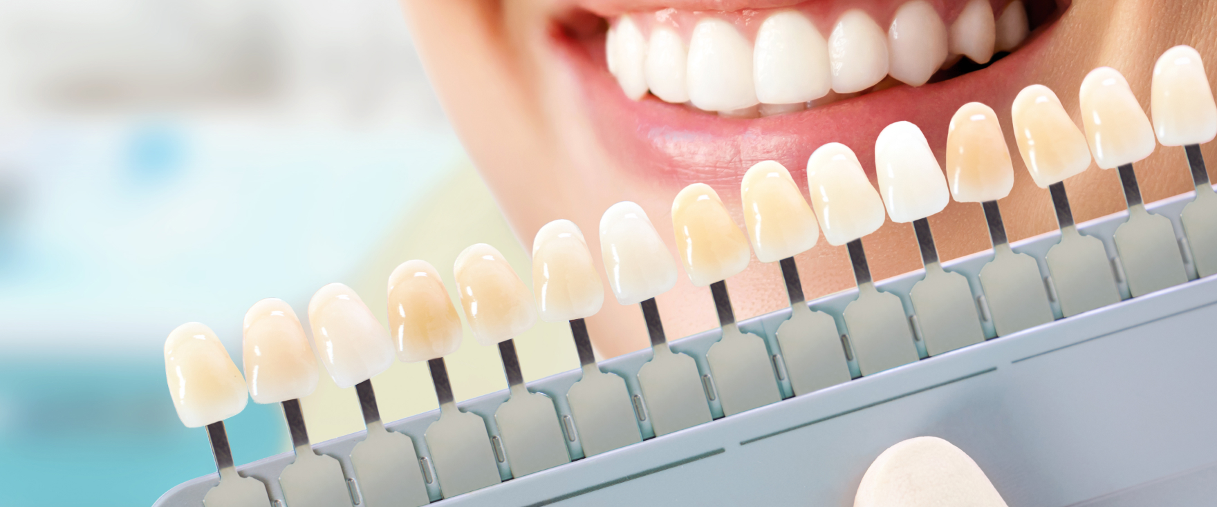 ホワイトニング